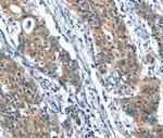 A4GALT Antibody in Immunohistochemistry (Paraffin) (IHC (P))