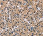 BAI2 Antibody in Immunohistochemistry (Paraffin) (IHC (P))