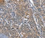 PLA2G6 Antibody in Immunohistochemistry (Paraffin) (IHC (P))