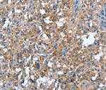 PLA2G6 Antibody in Immunohistochemistry (Paraffin) (IHC (P))