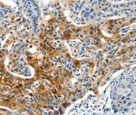 COG1 Antibody in Immunohistochemistry (Paraffin) (IHC (P))