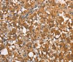 CALCRL Antibody in Immunohistochemistry (Paraffin) (IHC (P))