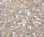 DTX1 Antibody in Immunohistochemistry (Paraffin) (IHC (P))