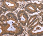 EAP2 Antibody in Immunohistochemistry (Paraffin) (IHC (P))