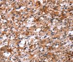 Glucagon Receptor Antibody in Immunohistochemistry (Paraffin) (IHC (P))