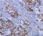 ID3 Antibody in Immunohistochemistry (Paraffin) (IHC (P))