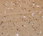 ITPR3 Antibody in Immunohistochemistry (Paraffin) (IHC (P))