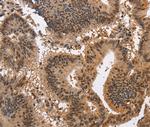 KCNG2 Antibody in Immunohistochemistry (Paraffin) (IHC (P))