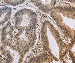 KCNG3 Antibody in Immunohistochemistry (Paraffin) (IHC (P))