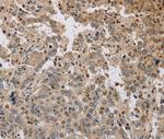 KCNG3 Antibody in Immunohistochemistry (Paraffin) (IHC (P))