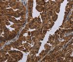 MAGEB3 Antibody in Immunohistochemistry (Paraffin) (IHC (P))