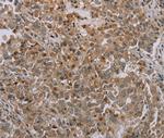 Mig-6 Antibody in Immunohistochemistry (Paraffin) (IHC (P))