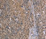 CAB39 Antibody in Immunohistochemistry (Paraffin) (IHC (P))