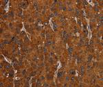 SLC22A12 Antibody in Immunohistochemistry (Paraffin) (IHC (P))