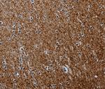 PCDHAC1 Antibody in Immunohistochemistry (Paraffin) (IHC (P))