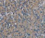 PHKG1 Antibody in Immunohistochemistry (Paraffin) (IHC (P))