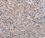 PLCL1 Antibody in Immunohistochemistry (Paraffin) (IHC (P))