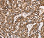 PPOX Antibody in Immunohistochemistry (Paraffin) (IHC (P))