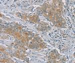 RASA2 Antibody in Immunohistochemistry (Paraffin) (IHC (P))