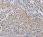 SAMD4B Antibody in Immunohistochemistry (Paraffin) (IHC (P))