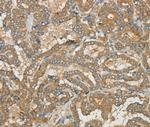 CWC27 Antibody in Immunohistochemistry (Paraffin) (IHC (P))