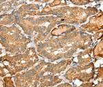 SIGLEC14 Antibody in Immunohistochemistry (Paraffin) (IHC (P))