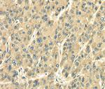 SDF4 Antibody in Immunohistochemistry (Paraffin) (IHC (P))