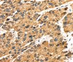 SLC25A26 Antibody in Immunohistochemistry (Paraffin) (IHC (P))