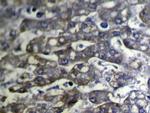 SLC25A2 Antibody in Immunohistochemistry (Paraffin) (IHC (P))