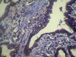 TCEB1 Antibody in Immunohistochemistry (Paraffin) (IHC (P))