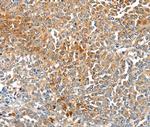 MAGEB2 Antibody in Immunohistochemistry (Paraffin) (IHC (P))