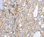 MAGEB2 Antibody in Immunohistochemistry (Paraffin) (IHC (P))