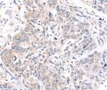 ROR1 Antibody in Immunohistochemistry (Paraffin) (IHC (P))