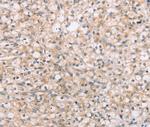 ROR1 Antibody in Immunohistochemistry (Paraffin) (IHC (P))