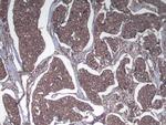 SRGAP1 Antibody in Immunohistochemistry (Paraffin) (IHC (P))