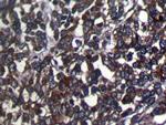 SRGAP1 Antibody in Immunohistochemistry (Paraffin) (IHC (P))