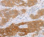 SUR1 Antibody in Immunohistochemistry (Paraffin) (IHC (P))