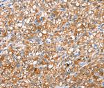 SUR1 Antibody in Immunohistochemistry (Paraffin) (IHC (P))