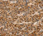 Talin 1 Antibody in Immunohistochemistry (Paraffin) (IHC (P))