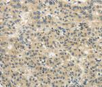 WDR91 Antibody in Immunohistochemistry (Paraffin) (IHC (P))