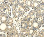 WDR91 Antibody in Immunohistochemistry (Paraffin) (IHC (P))