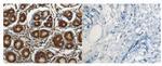 RASAL2 Antibody in Immunohistochemistry (Paraffin) (IHC (P))