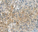 UPP2 Antibody in Immunohistochemistry (Paraffin) (IHC (P))