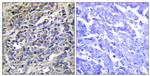 Granzyme K Antibody in Immunohistochemistry (Paraffin) (IHC (P))