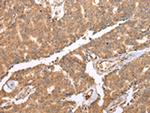 UQCRC2 Antibody in Immunohistochemistry (Paraffin) (IHC (P))