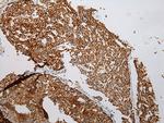 VDAC3 Antibody in Immunohistochemistry (Paraffin) (IHC (P))