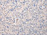 CHMP3 Antibody in Immunohistochemistry (Paraffin) (IHC (P))