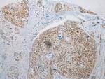 WDR45 Antibody in Immunohistochemistry (Paraffin) (IHC (P))