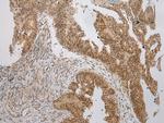 WSB1 Antibody in Immunohistochemistry (Paraffin) (IHC (P))