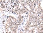 PCID2 Antibody in Immunohistochemistry (Paraffin) (IHC (P))